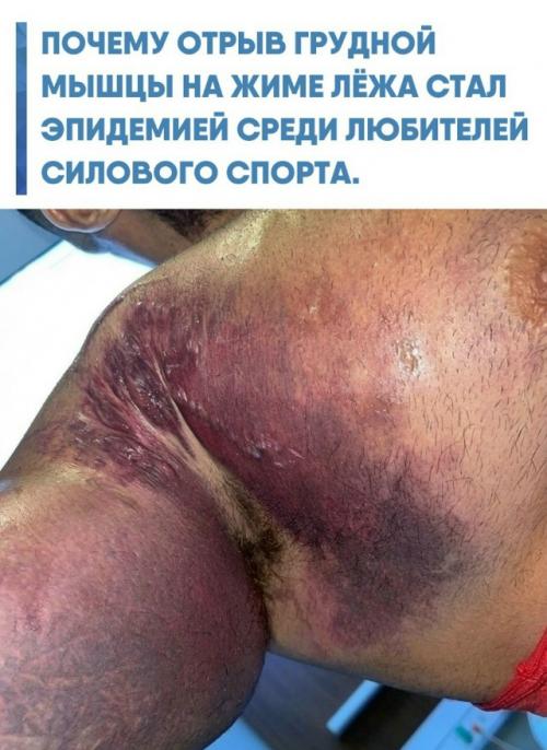 Когда штанга касается груди, волокна большой грудной мышцы находятся в фазе максимального эксцентрического растяжения.  