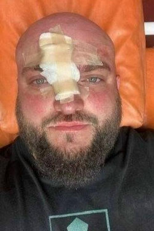 В одесской области военного избили арматурой за требование выключить русскоязычную музыку.

