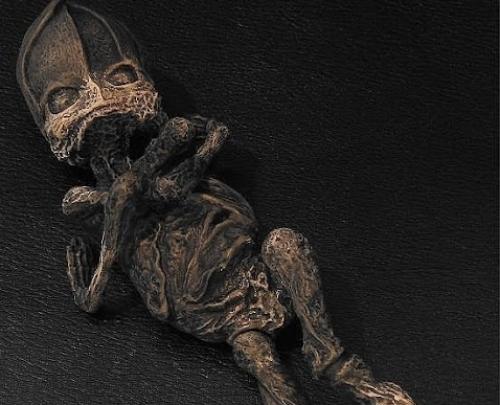 Кыштымский карлик: был ли он пришельцем из космоса. 04 Кыштымский карлик: был ли он пришельцем из космоса. 04