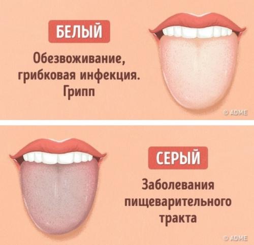 Как определить состояние здоровья по цвету языка? 03