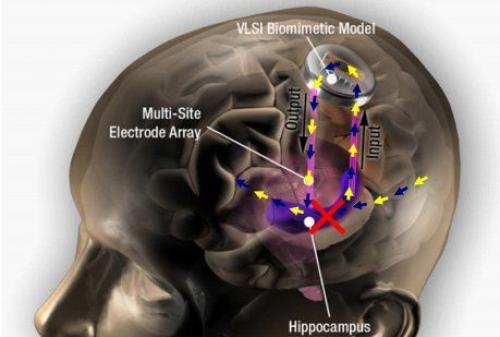 Разрабатывается нейро - имплант для улучшения памяти.