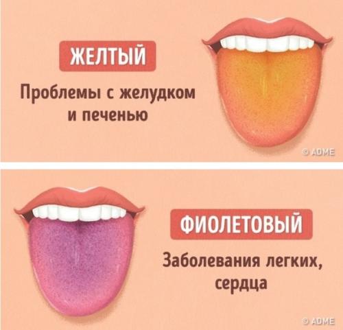 Как определить состояние здоровья по цвету языка? 01