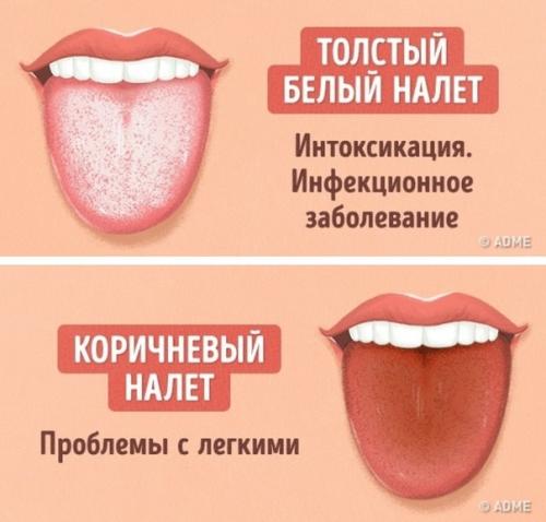 Как определить состояние здоровья по цвету языка? 04